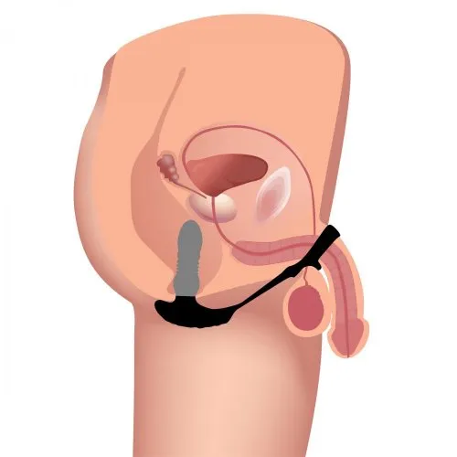 THUNDERPLUGS 10X THRUSTING SILICONE PLUG W/ COCK AND BALL RING